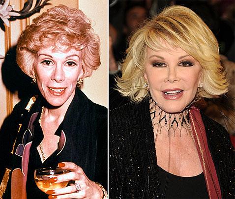 Самые известные жертвы пластической хирургии