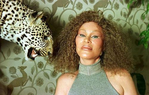 Самые известные жертвы пластической хирургии