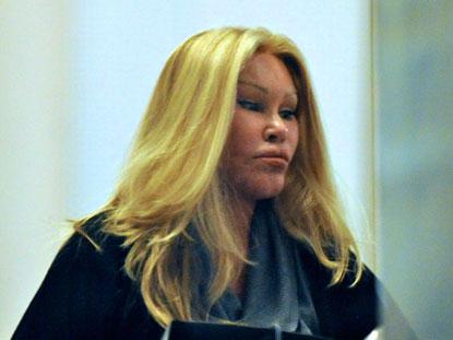 Самые известные жертвы пластической хирургии