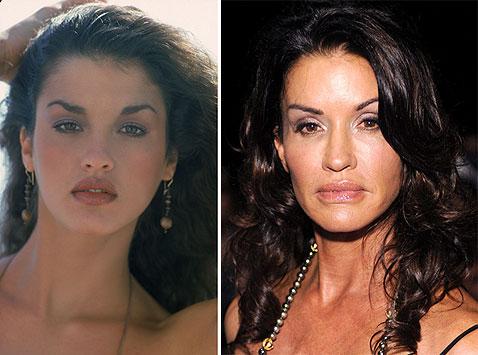 Самые известные жертвы пластической хирургии