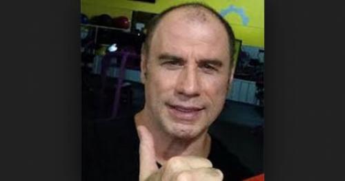 Знаменитости, которые неожиданно сильно постарели