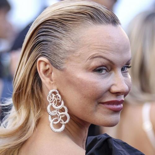 Знаменитости, которые неожиданно сильно постарели