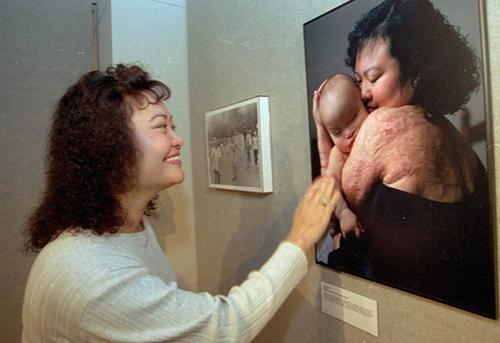 Девочка со знаменитого снимка выжила!..