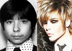 Новый образ Сергея Зверева… Опять пластика?