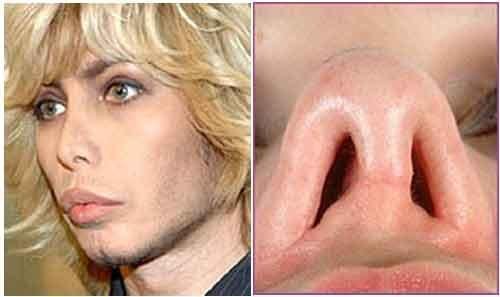 Новый образ Сергея Зверева… Опять пластика?