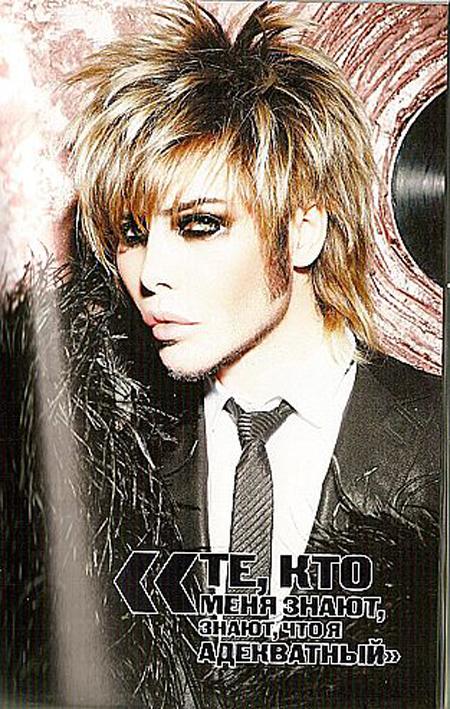 Новый образ Сергея Зверева… Опять пластика?