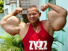 Очередная жертва синтола: бразильский Халк