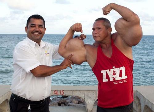 Очередная жертва синтола: бразильский Халк