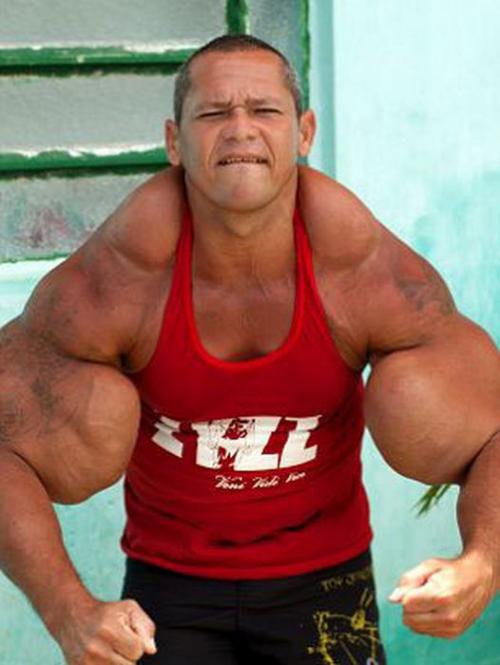 Очередная жертва синтола: бразильский Халк