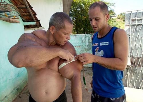 Очередная жертва синтола: бразильский Халк