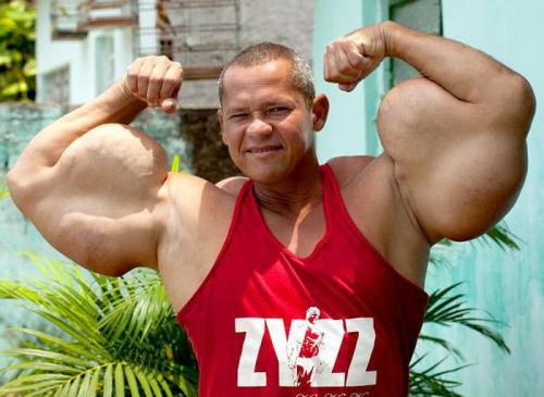 Очередная жертва синтола: бразильский Халк