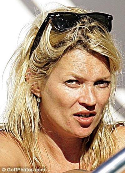 Звёзды, незаслуженно получившие титул секс-символа