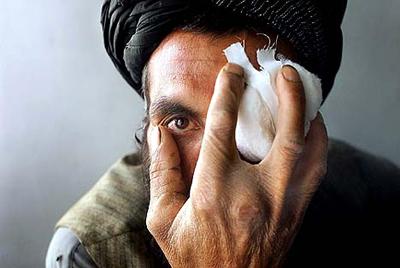 2002
Издание: The New York Times
Фотохроники о боли и выносливости людей, попавших в эпицентры конфликтов в Афганистане и Пакистане. На фото - Фазал Мухаммад, потерявший сына во время атаки американской авиации на Кандагар, октябрь 2001 года.