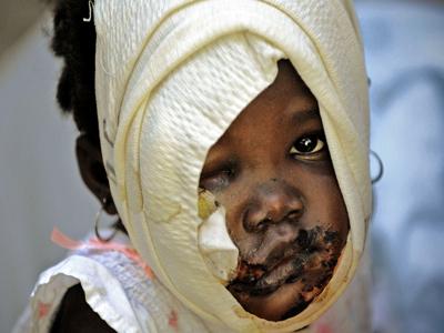 Лучшие фото мира, удостоенные «Пулитцеровской премии»