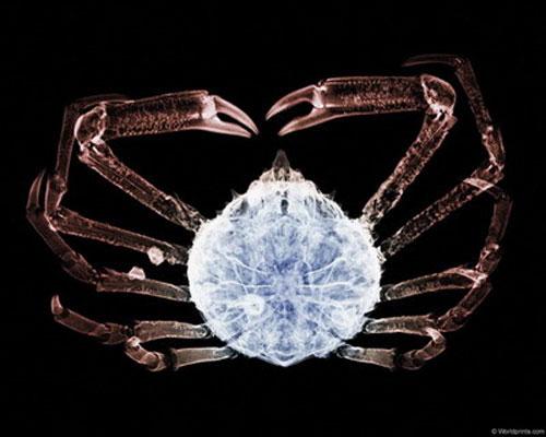 Откровение от Рентгена