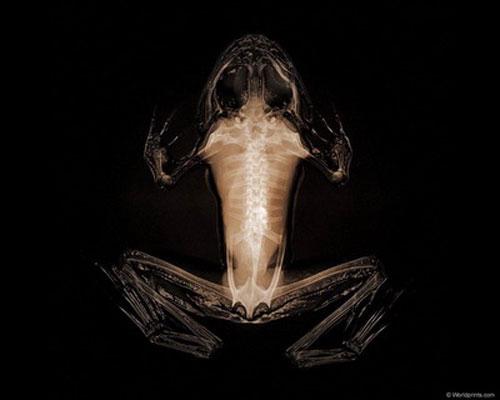 Откровение от Рентгена