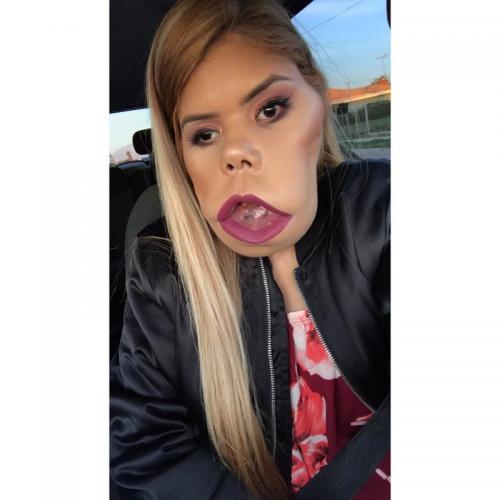 Маримар Кироа — бьюти-блогер с огромной опухолью на лице