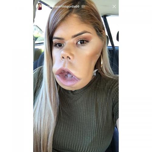 Маримар Кироа — бьюти-блогер с огромной опухолью на лице