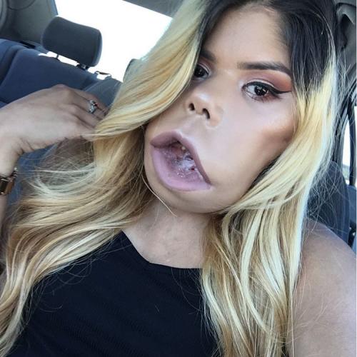 Маримар Кироа — бьюти-блогер с огромной опухолью на лице