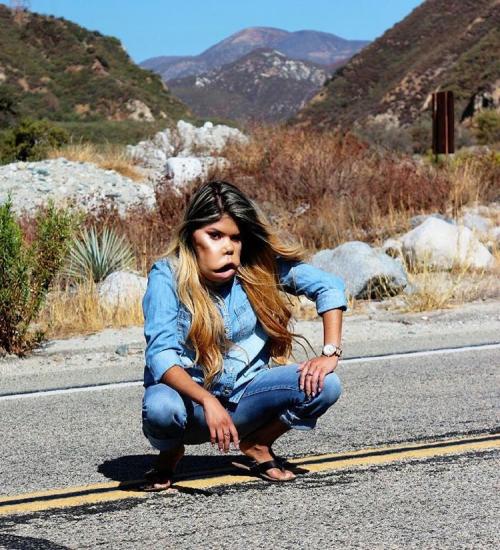 Маримар Кироа — бьюти-блогер с огромной опухолью на лице