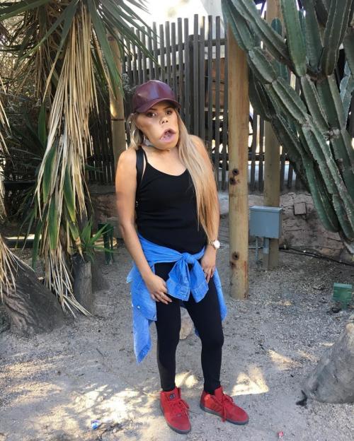 Маримар Кироа — бьюти-блогер с огромной опухолью на лице