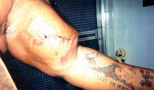 Жертвы стероидов: массовая "химизация" калечит своих героев