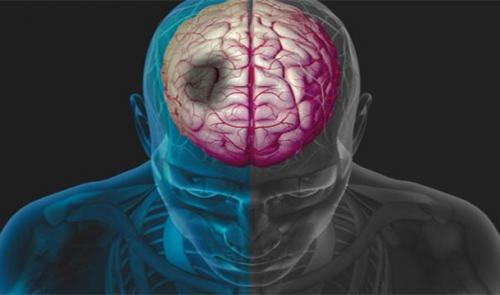 Каковы шансы умереть от того или иного бедствия