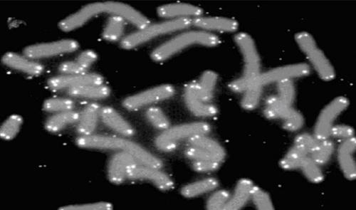 Каковы шансы умереть от того или иного бедствия