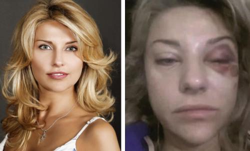 Самые громкие скандалы и ссоры российских знаменитостей