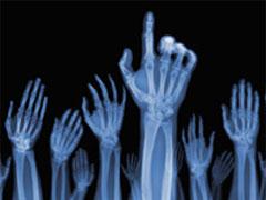 Ник Визи: рентген-версия мира