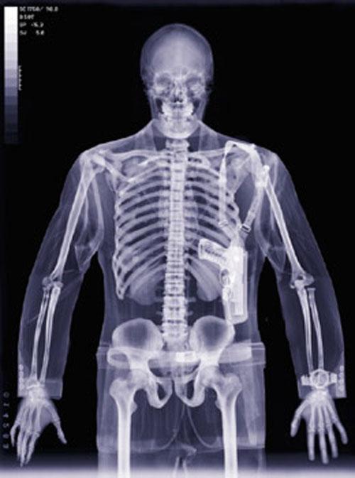 Ник Визи: рентген-версия мира