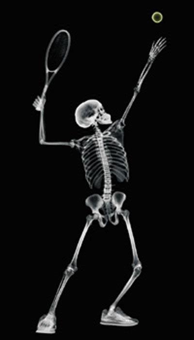 Ник Визи: рентген-версия мира