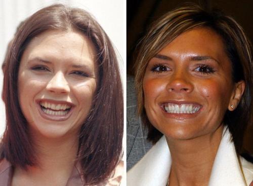 Как зубы изменили внешность знаменитостей