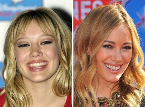 Как зубы изменили внешность знаменитостей