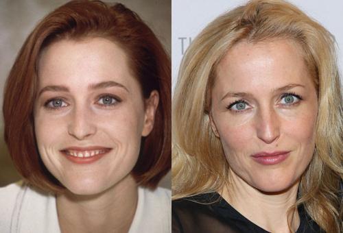 Как сейчас выглядят герои любимых сериалов