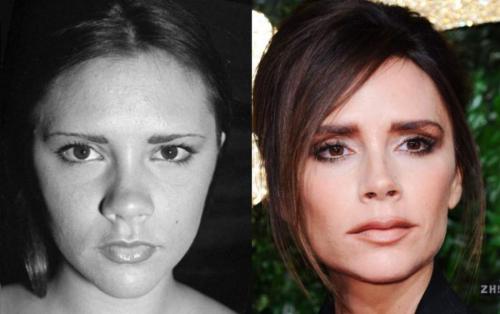 Звезды, которым пластика пошла на пользу