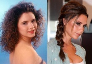 Звезды, которым пластика пошла на пользу