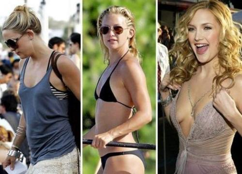 Звезды, которым пластика пошла на пользу