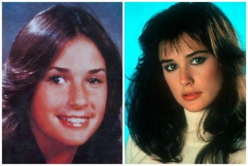 Звезды, которым пластика пошла на пользу