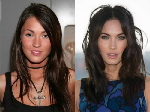 Звезды, которым пластика пошла на пользу