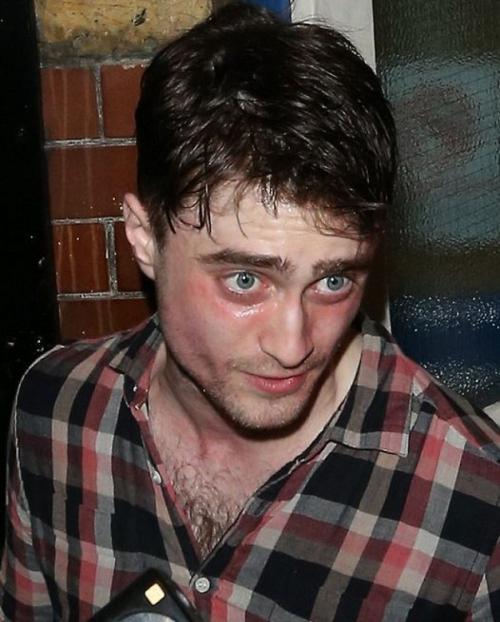 Знаменитости, которых чуть не погубил алкоголь