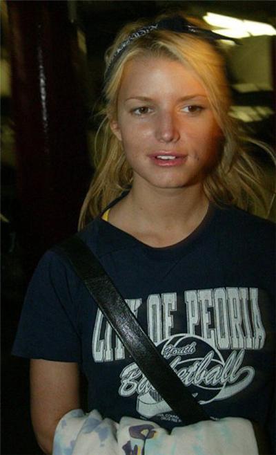 Неудачные фото звезд. Часть 2