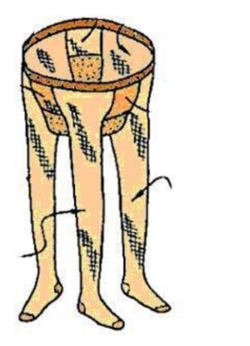 10 нелепейших патентов в истории