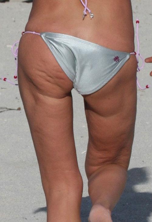 У Тары Рейд выскочил целлюлит