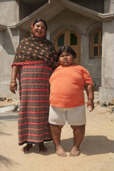 Самая толстая девочка планеты живет в Индии
