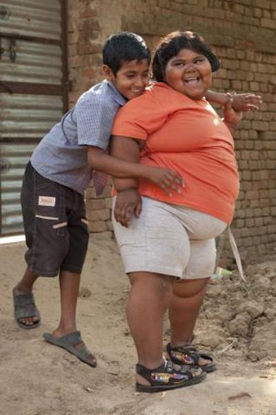 Самая толстая девочка планеты живет в Индии