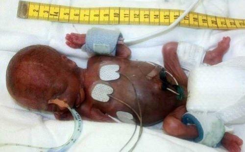 Самые крупные и крохотные младенцы