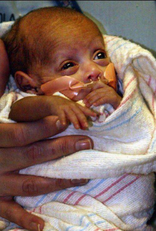 Самые крупные и крохотные младенцы