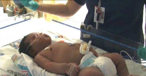 Самые крупные и крохотные младенцы