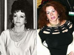 Миссис Сталлоне переборщила с пластикой